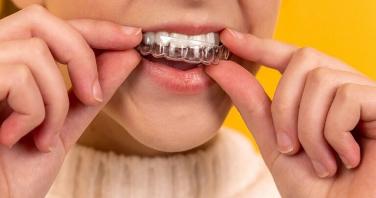 Cloverdale Dental Centre – Best Cloverdale Dentist Surrey