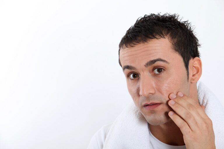 Should I Moisturize After Mmicro Nneedling